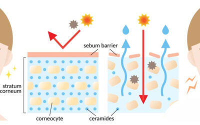manfaat ceramide untuk merawat kulit