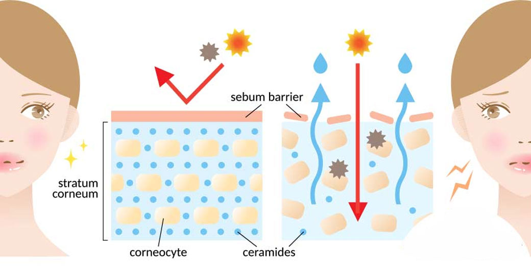 ceramide kulit